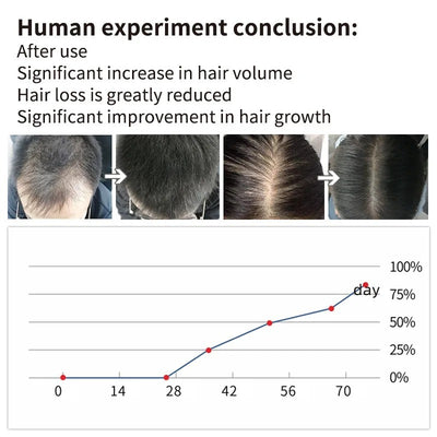 Hair Root Eyelash Growth Liquid Hair Growth Hair Renewal Liquid